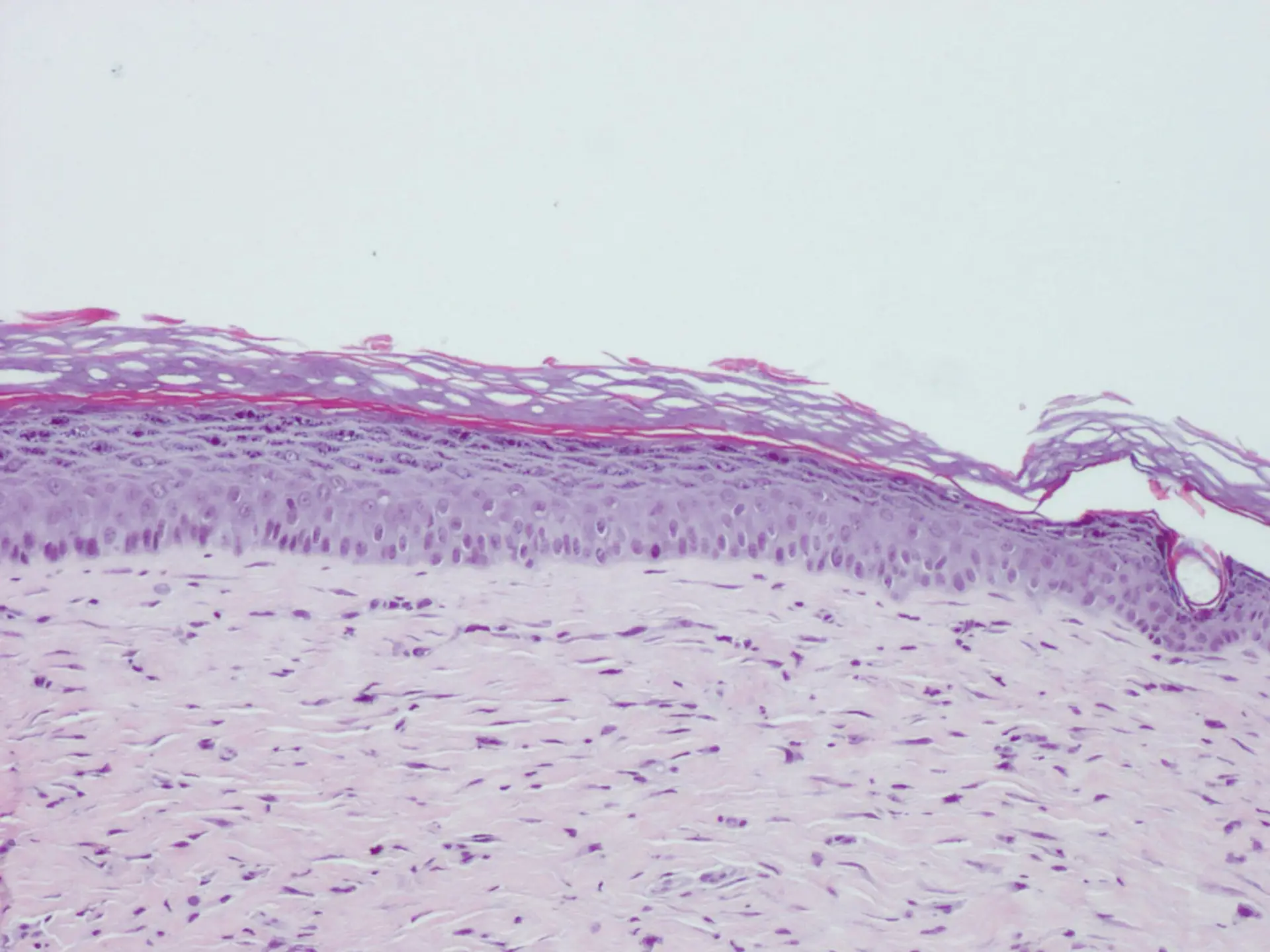 Investigadores de Coimbra descobrem proteínas que podem ser úteis no combate ao cancro