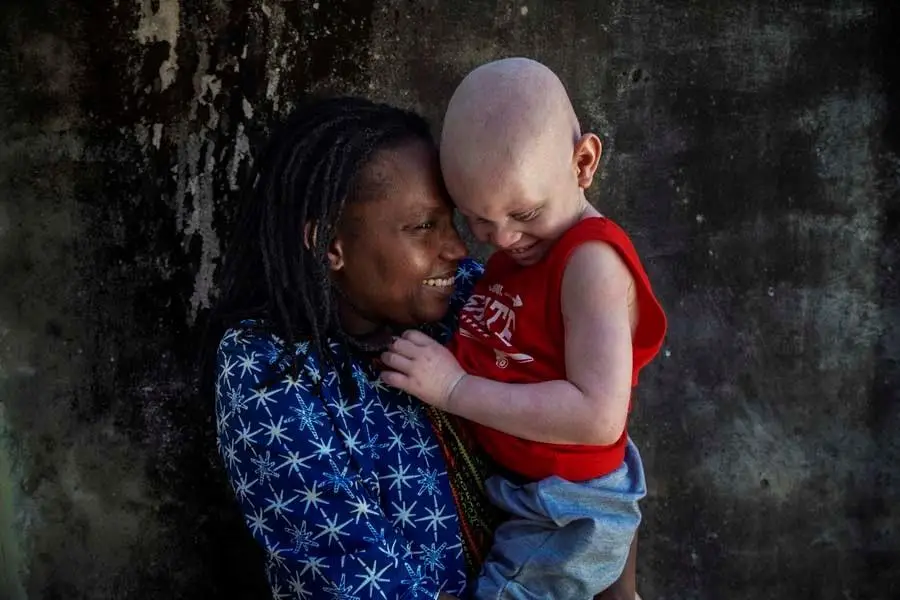 Flavia Pinto, responsável pela organização de voluntários Azemap, que apoia pessoas albinas, com uma criança que está em processo de adotar. O pai da criança tentou vendê-la.