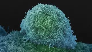 Cientistas investigam como nasce o cancro