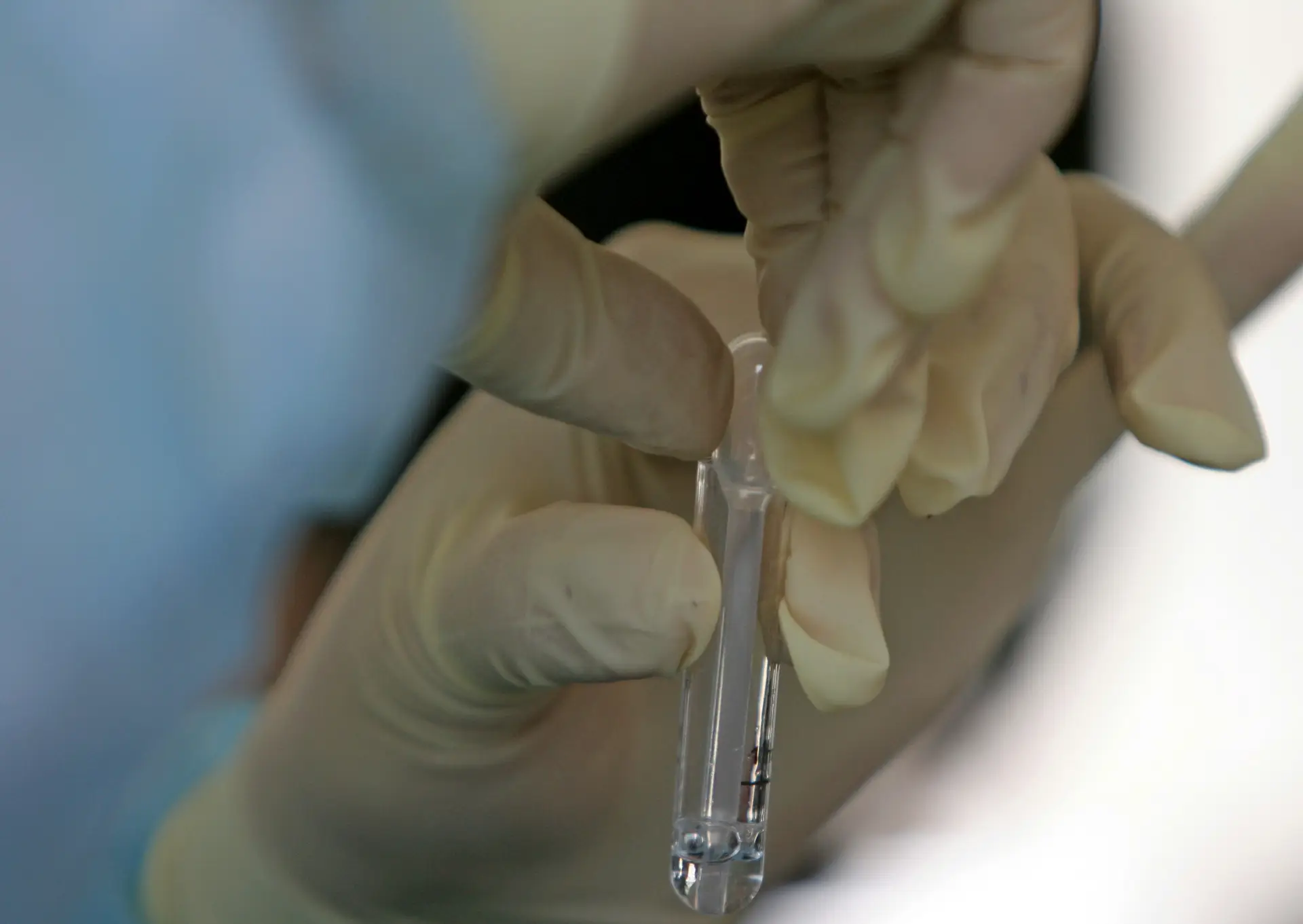 Nanopartícula com glúten pode reverter doença celíaca