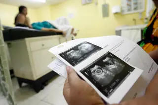 Investigada clínica onde foram feitas ecografias à mãe do bebé que nasceu sem rosto