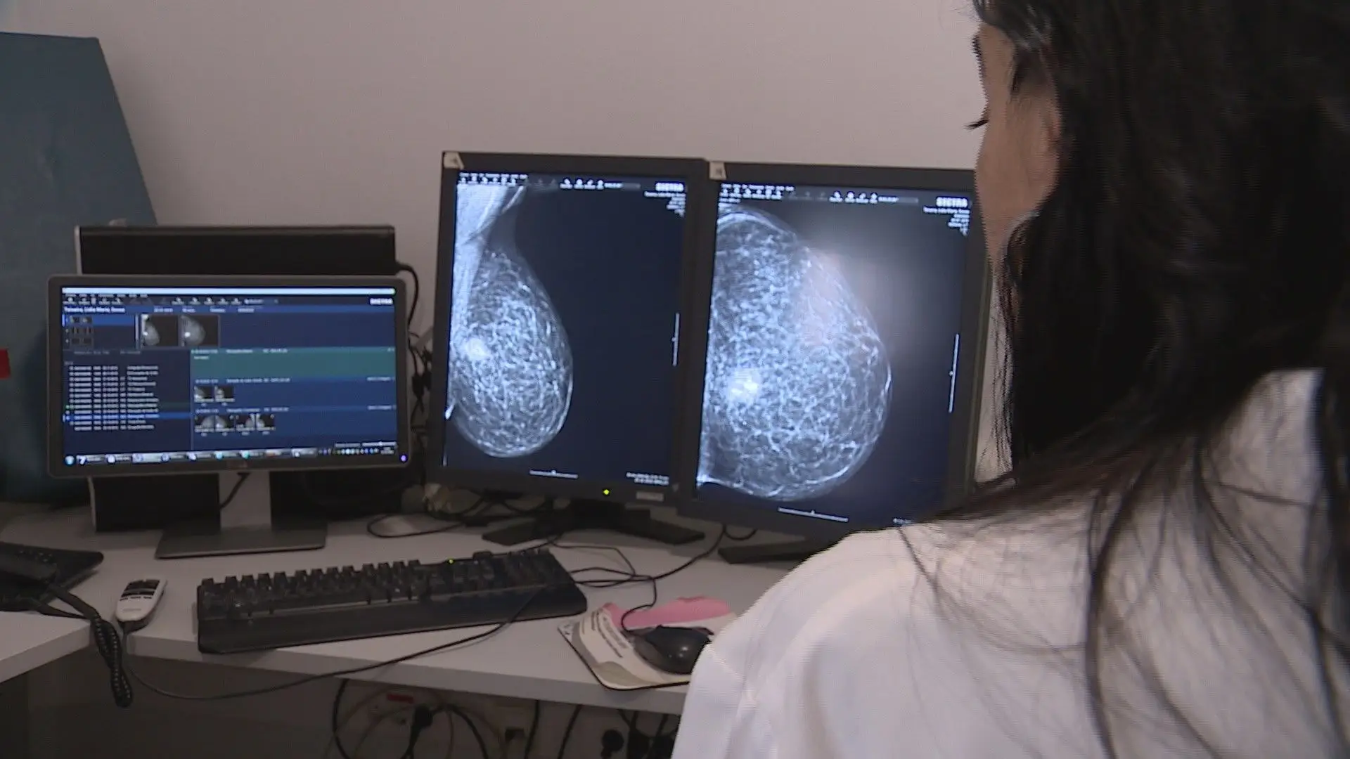 Se tem entre 45 e 74 anos lembre-se: deve realizar o rastreio contra o cancro da mama