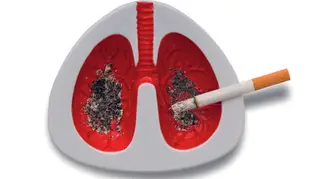"Entre 85% a 90% dos casos de cancro do pulmão ocorrem em fumadores"
