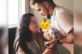 O que se sabe do caso de Rodrigo, o bebé que nasceu sem parte do rosto