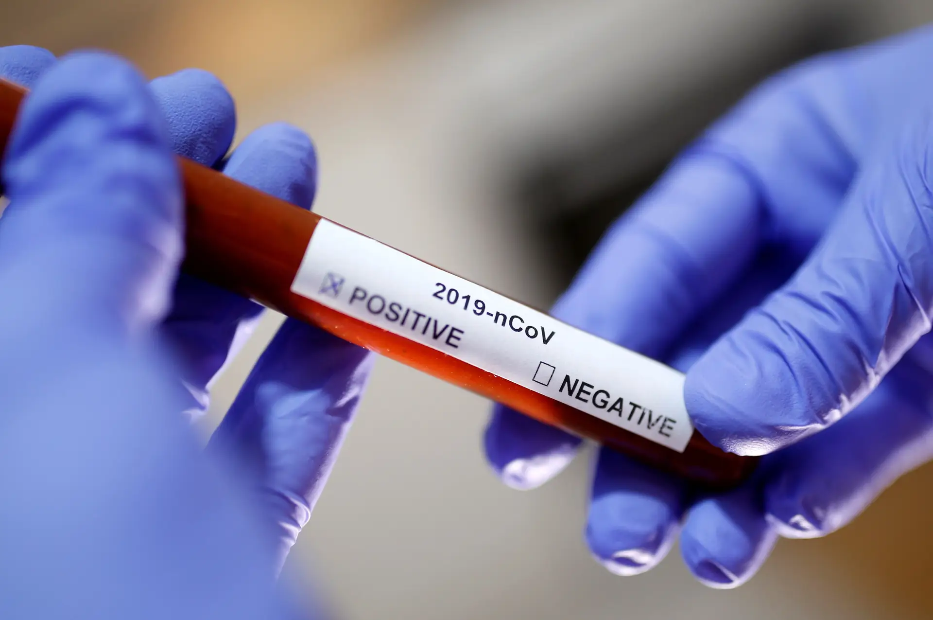 Investigadores britânicos anunciam testes a vacinas contra o coronavírus