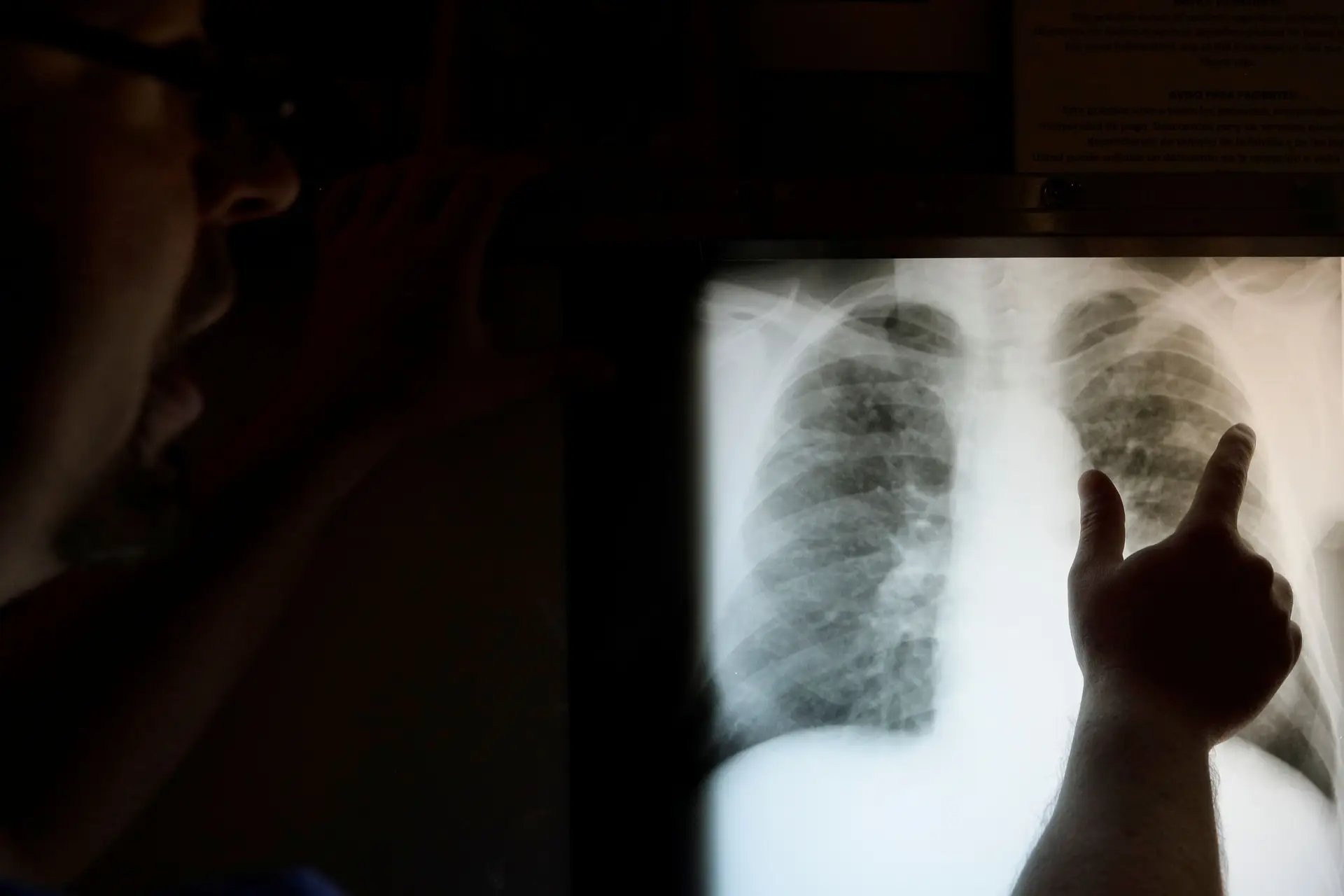 OMS aconselha testes à Covid-19 a todos os doentes que tiveram suspeita de pneumonia