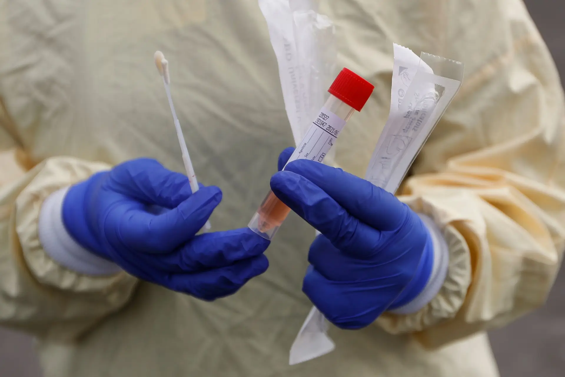 DGS admite a possibilidade de testes de despiste de Covid-19 em massa