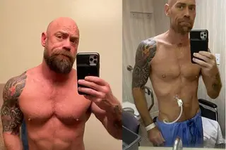 Enfermeiro com Covid-19 perdeu 20 kg após 6 semanas de internamento