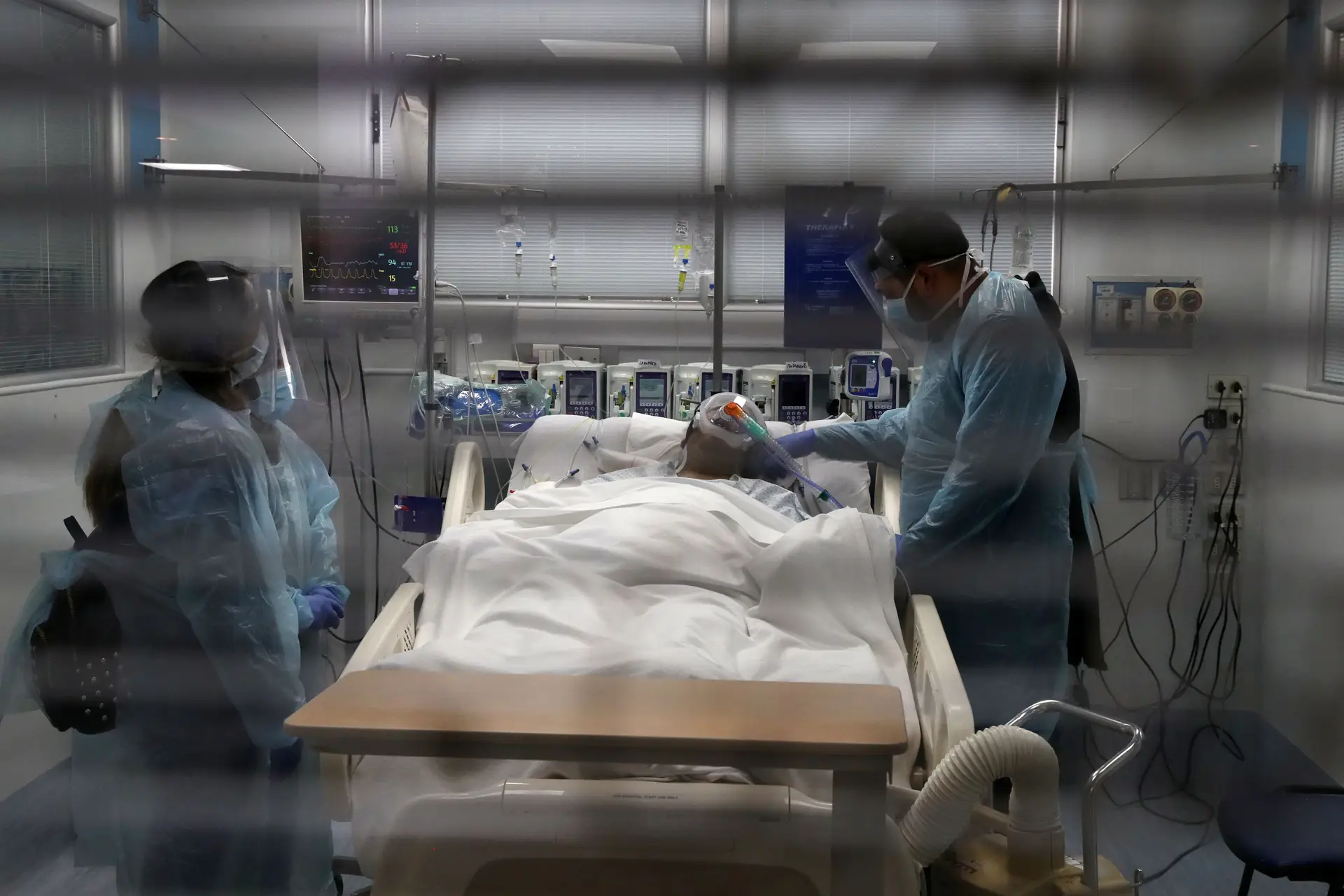 Covid-19 pode causar complicações neurológicas graves