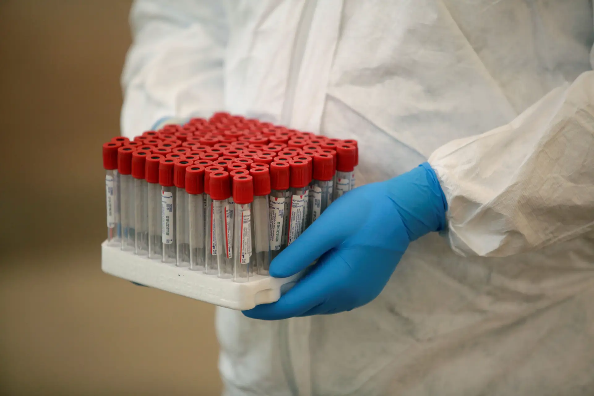 Covid-19: Pandemia já causou mais de 596 mil mortos e 14 milhões de infetados no mundo