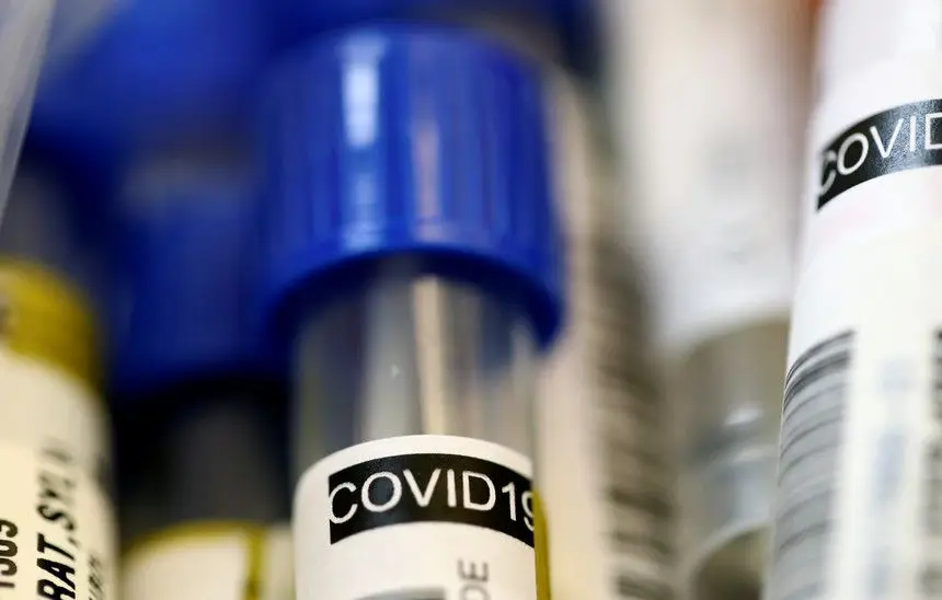 Covid-19: Militares reforçam rastreio de contactos e realização inquéritos epidemiológicos