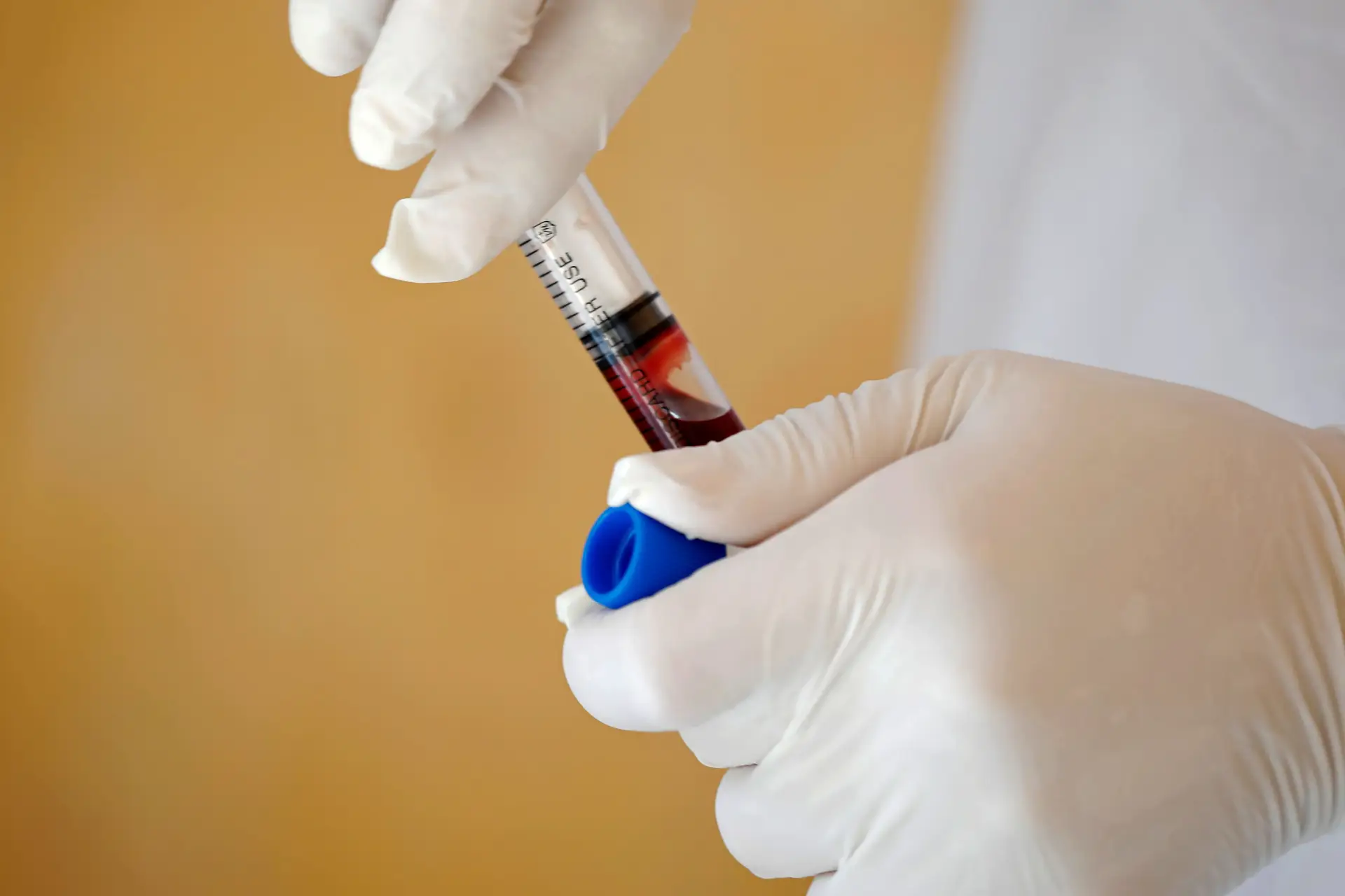 Autoridades de saúde validam testes rápidos à Covid-19 para doentes sintomáticos