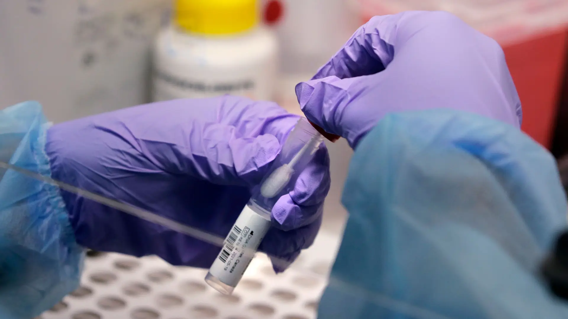 Covid-19: Assintomáticos podem ter tanta carga viral como doentes com sintomas