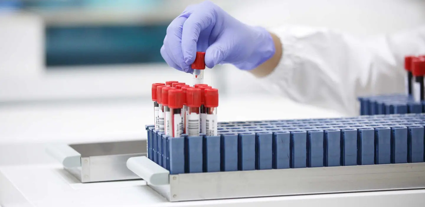 Farmacêutica Roche promete um novo teste rápido à Covid-19 ainda este ano