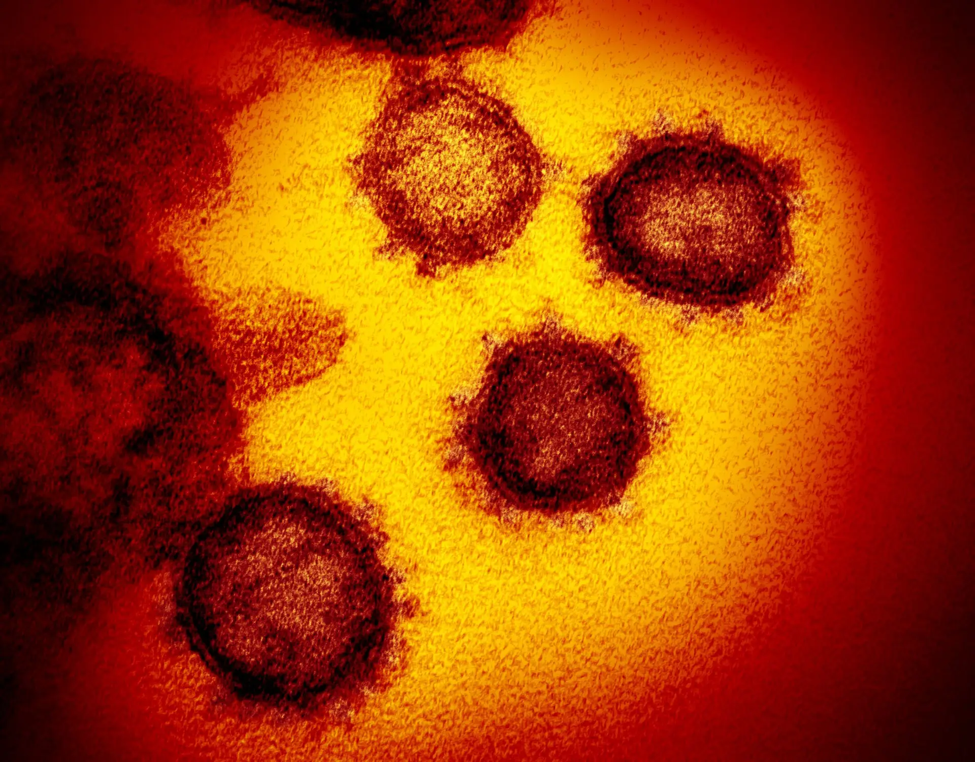 Covid-19: Brasil anuncia identificação preliminar de dois casos da Ómicron