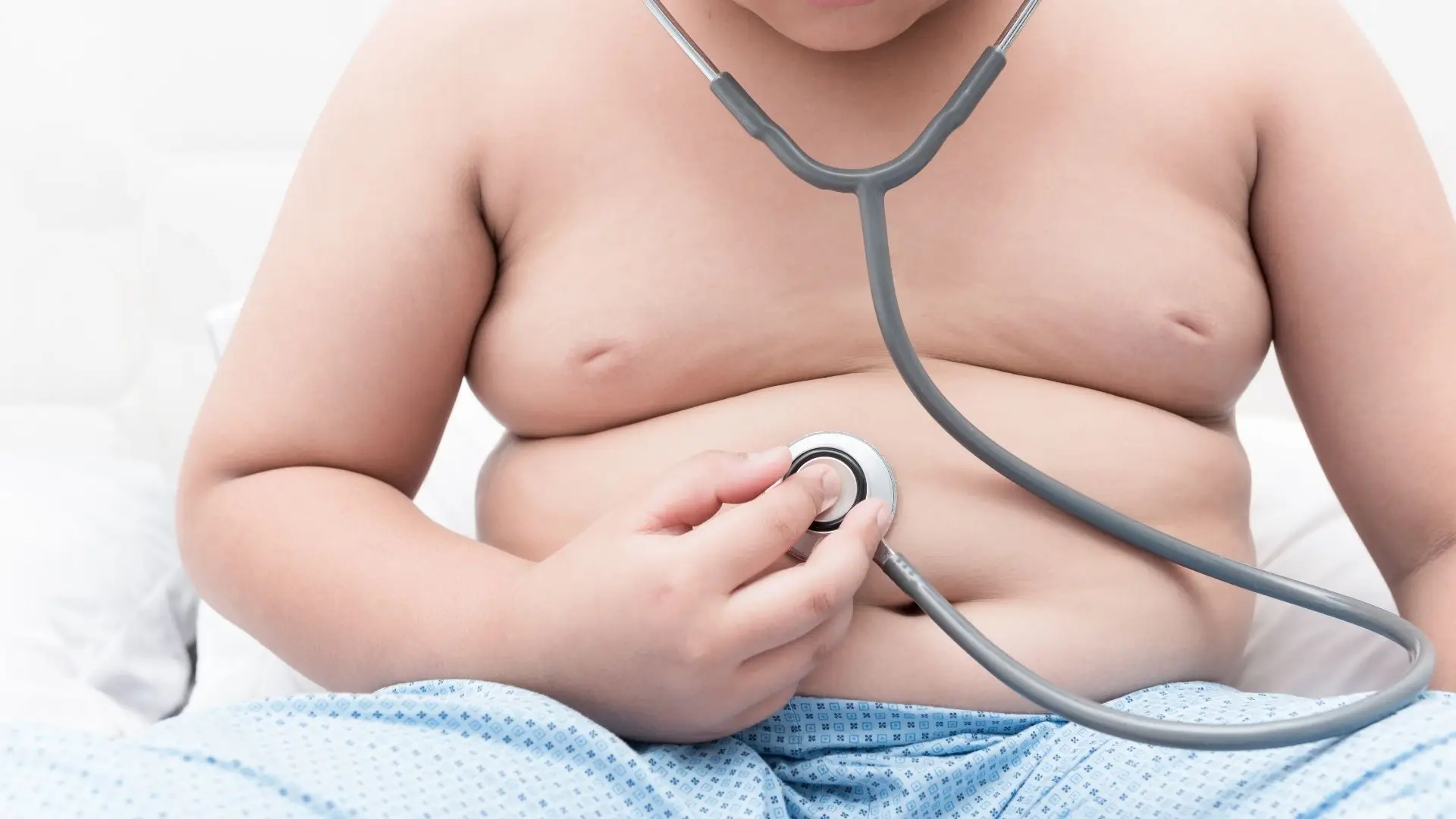 Obesidade infantil afeta mais as meninas, apesar de registar diminuição generalizada