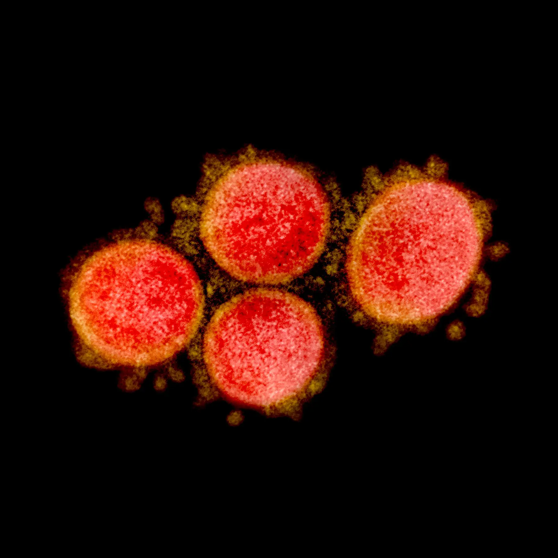 Investigadores norte-americanos identificam duas variantes de coronavírus