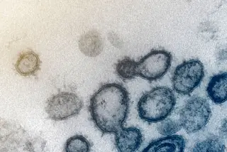 Covid-19. Casos da mutação da variante indiana estão controlados em Portugal, dizem especialistas