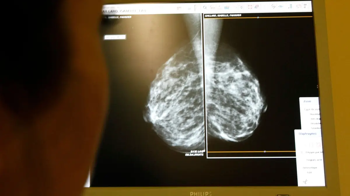 O avançar da idade faz aumentar o risco de cancro da mama. Uma mulher de 60 anos, por exemplo, tem oito vezes mais hipóteses de desenvolver a doença em 5 anos, do que uma mulher de 30