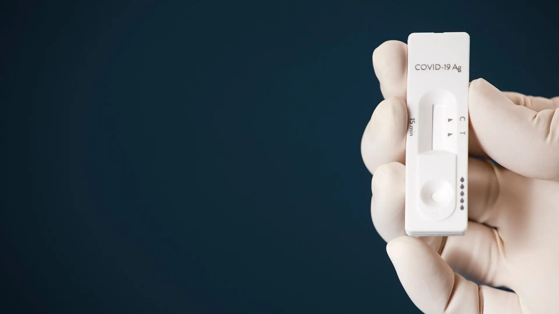 Covid-19. Autotestes passam a integrar Estratégia Nacional de Testes para SARS-CoV-2