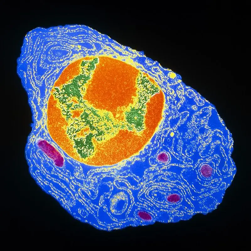 Uma célula plasmática da medula óssea (colorida artificialmente), células, que produzem anticorpos.