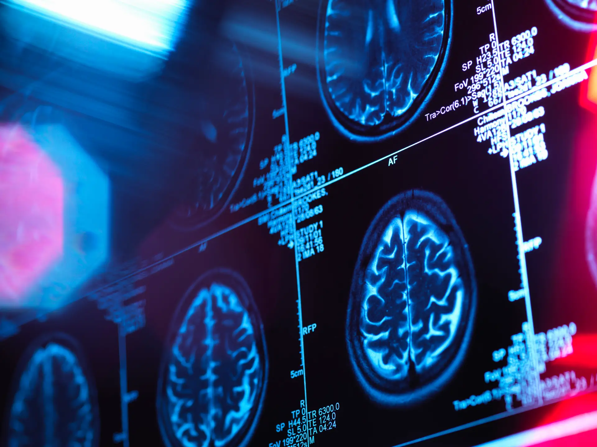 Prémios Santa Casa Neurociências distinguem estudos terapêuticos para Alzheimer e lesões vertebro-medulares