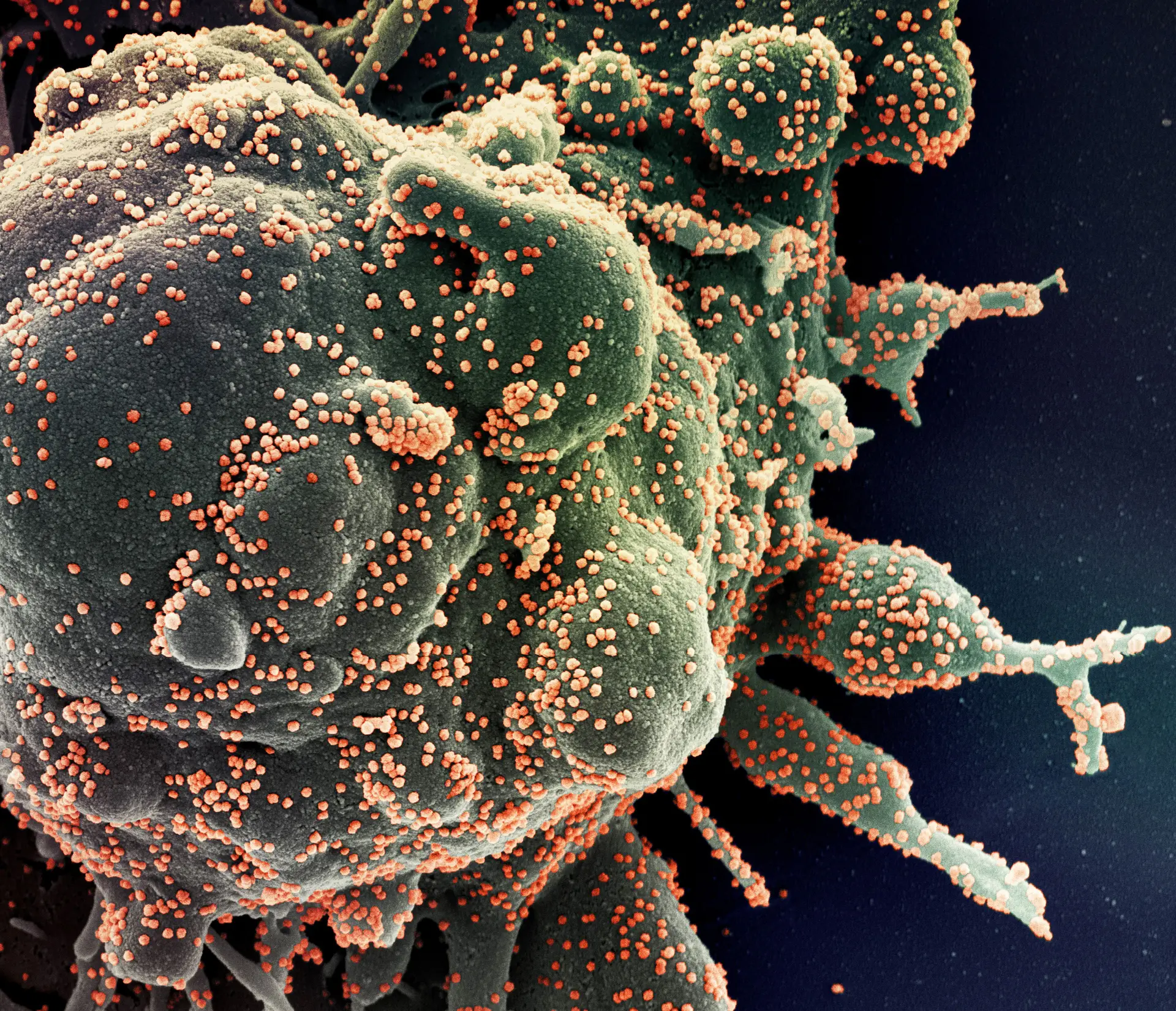 AstraZeneca admite que tratamento com anticorpos não provou eficácia
