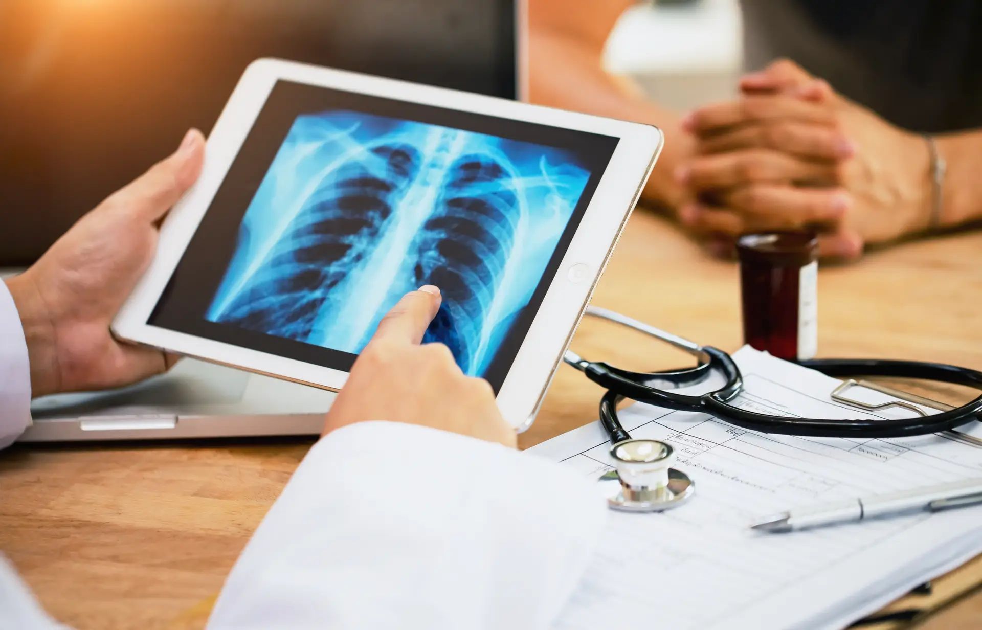 Entre 85% a 90% dos casos de cancro do pulmão ocorrem em fumadores