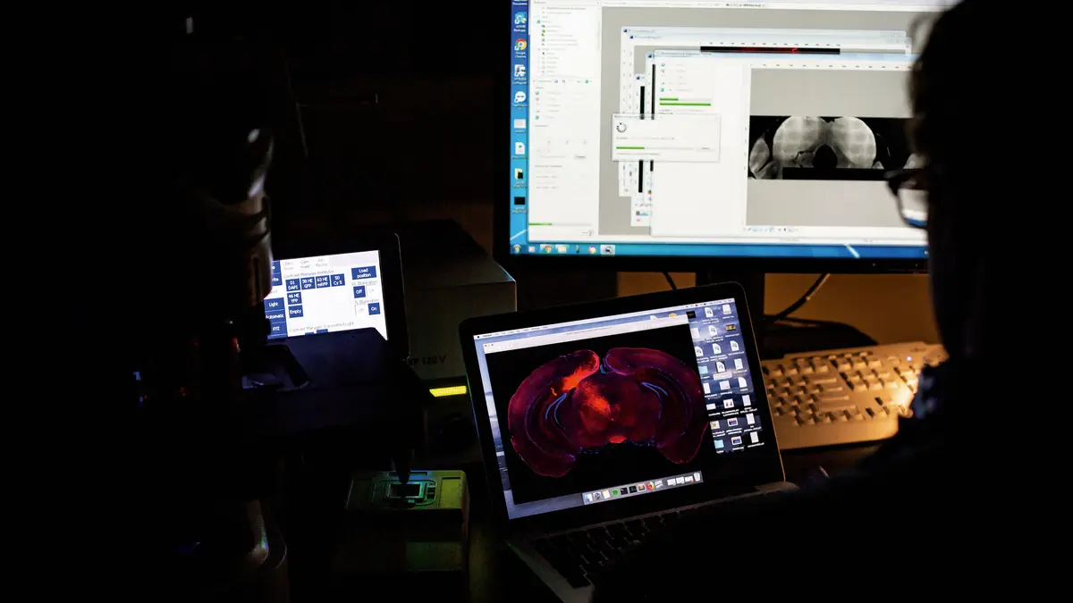 Perto de 450 mil rastreios aos cancros da mama, do útero e do colo e reto ficaram por realizar no primeiro ano de pandemia