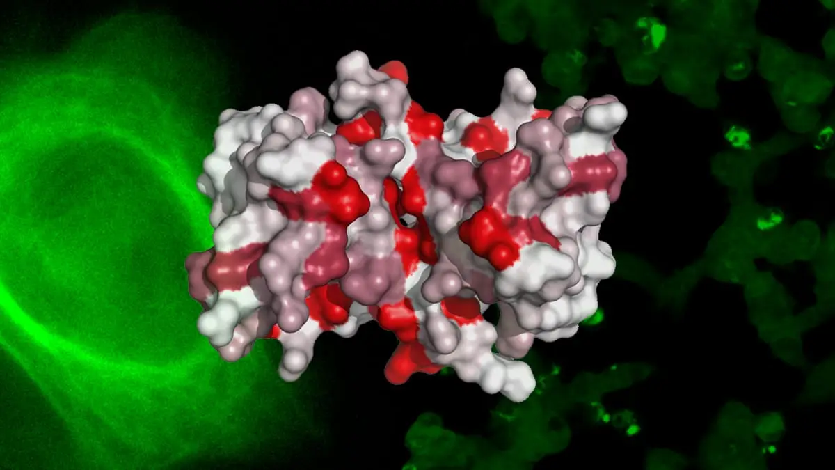 Investigação liderada por português descobre que proteína no cérebro atrasa "origem" de Alzheimer