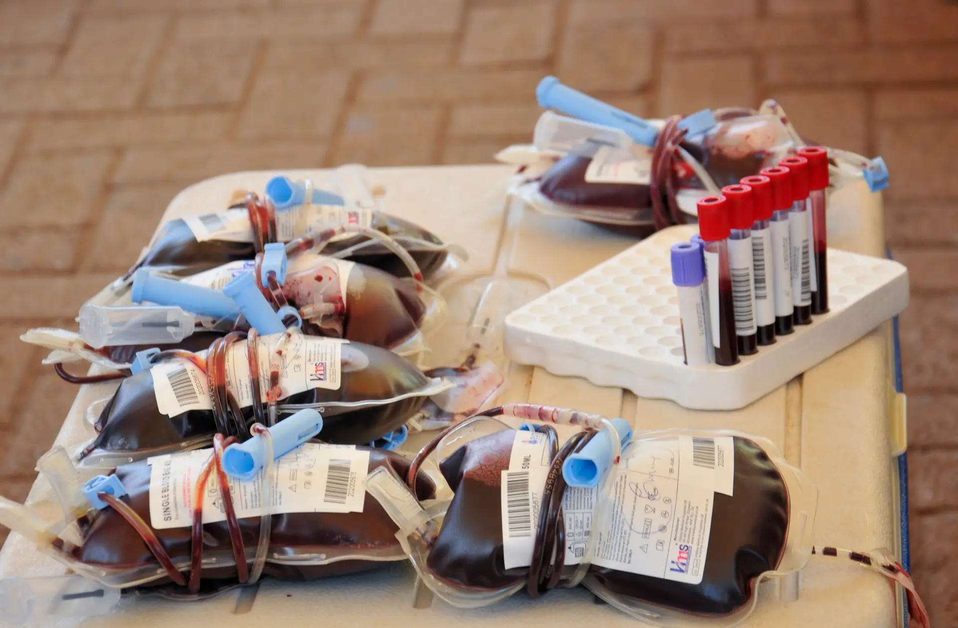 França vai permitir doação de sangue a homossexuais sem condicionantes
