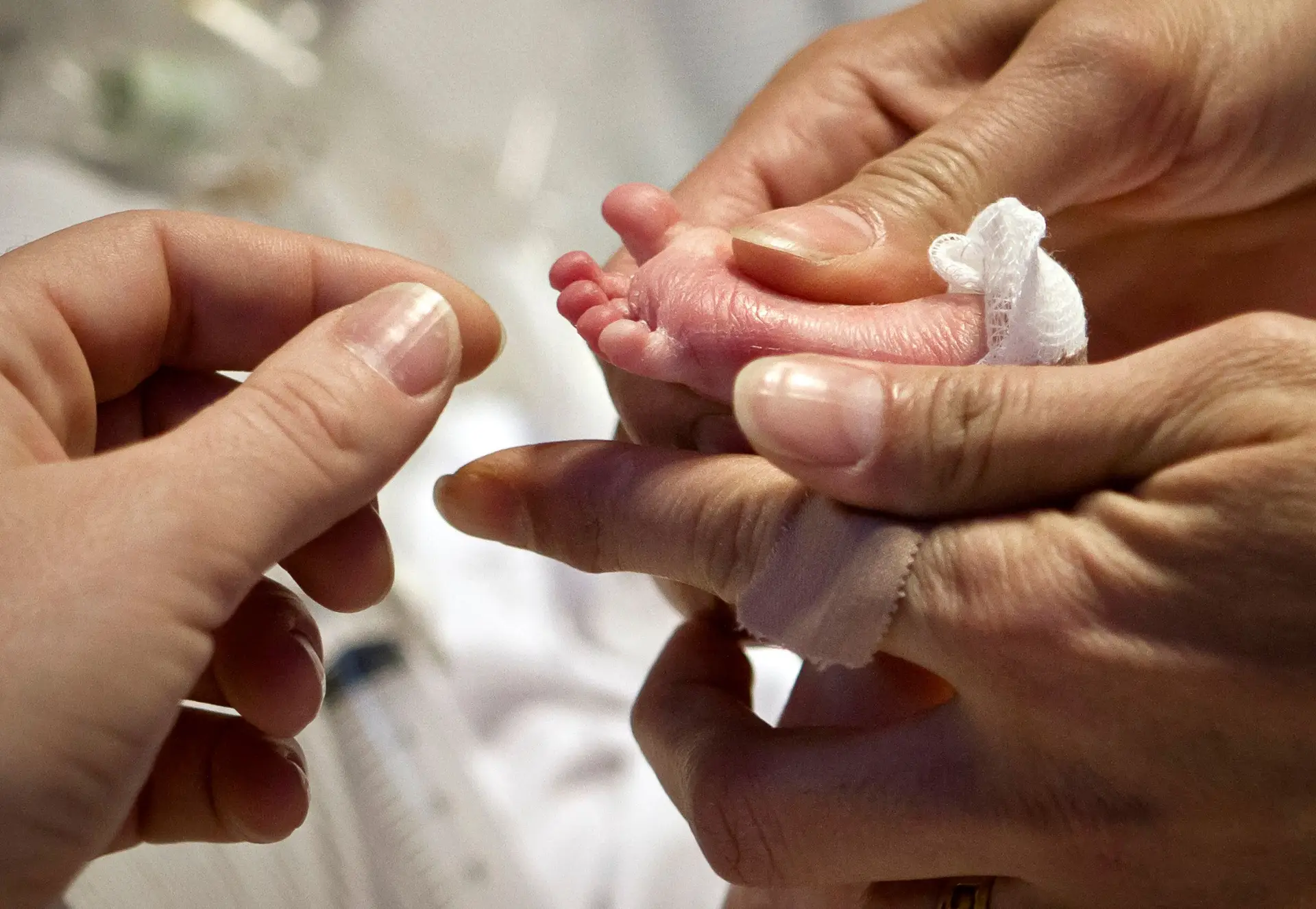 Teste do Pezinho rastreou pela primeira vez menos de 80 mil bebés em Portugal