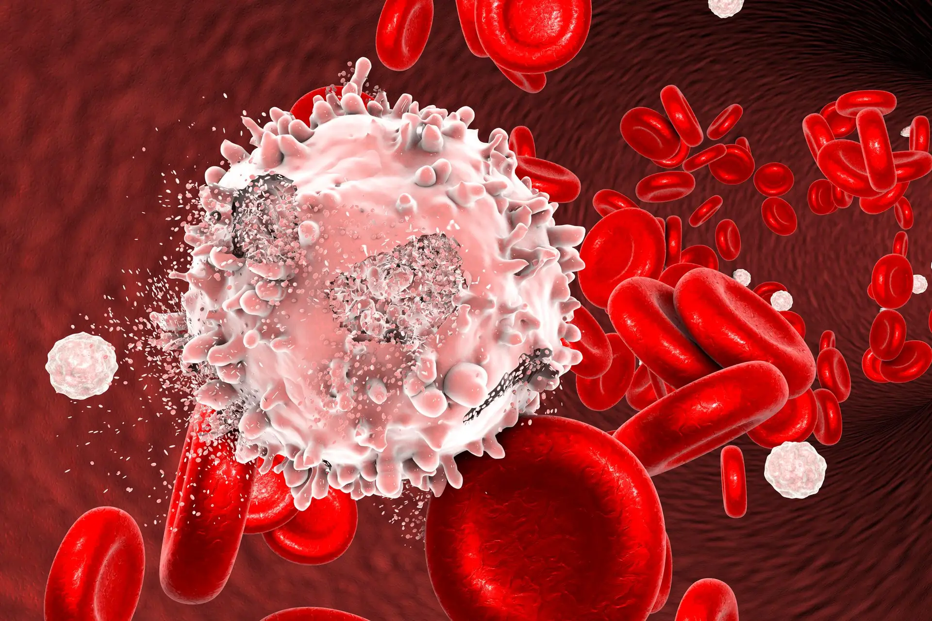 Pacientes diagnosticados com leucemia curados devido a terapia com células CAR-T