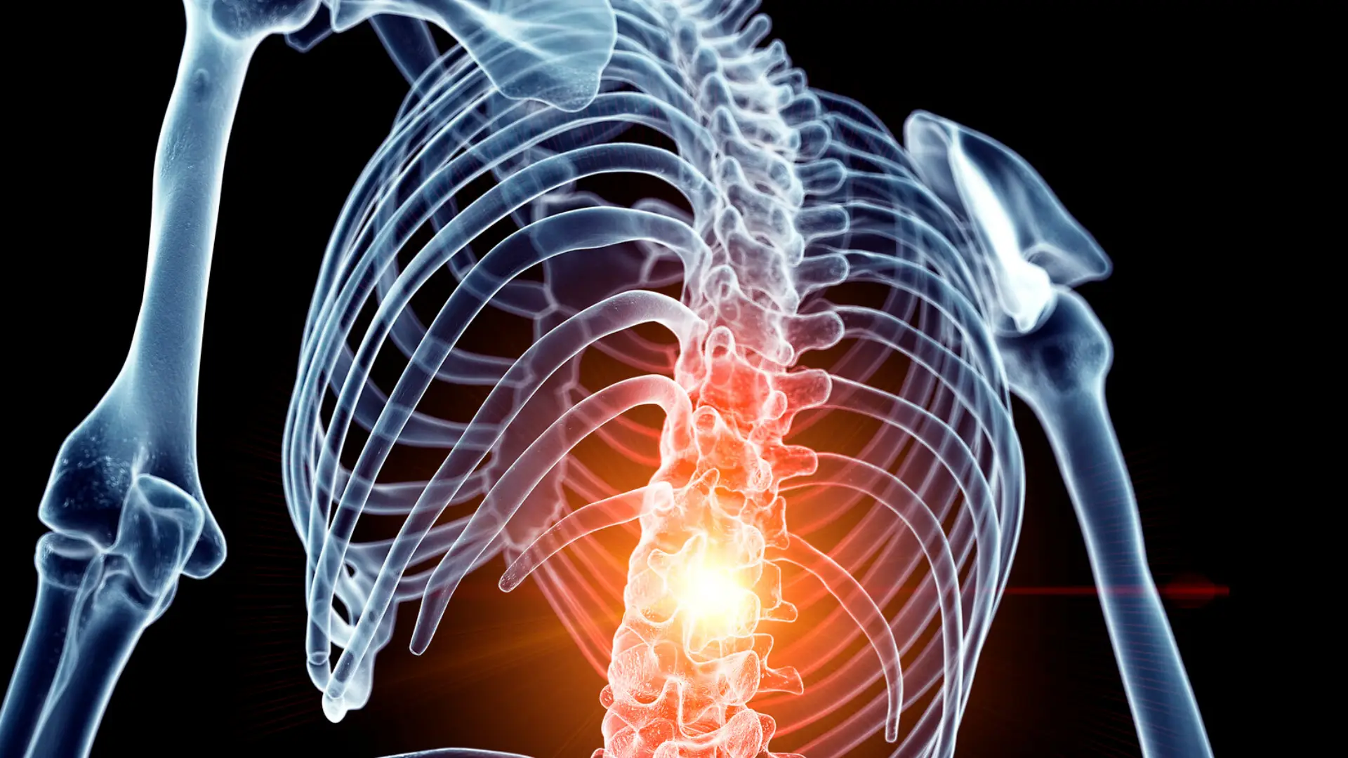 Implantes eletrónicos para paraplégicos são “passo bastante importante” no tratamento de lesões vertebro-medulares