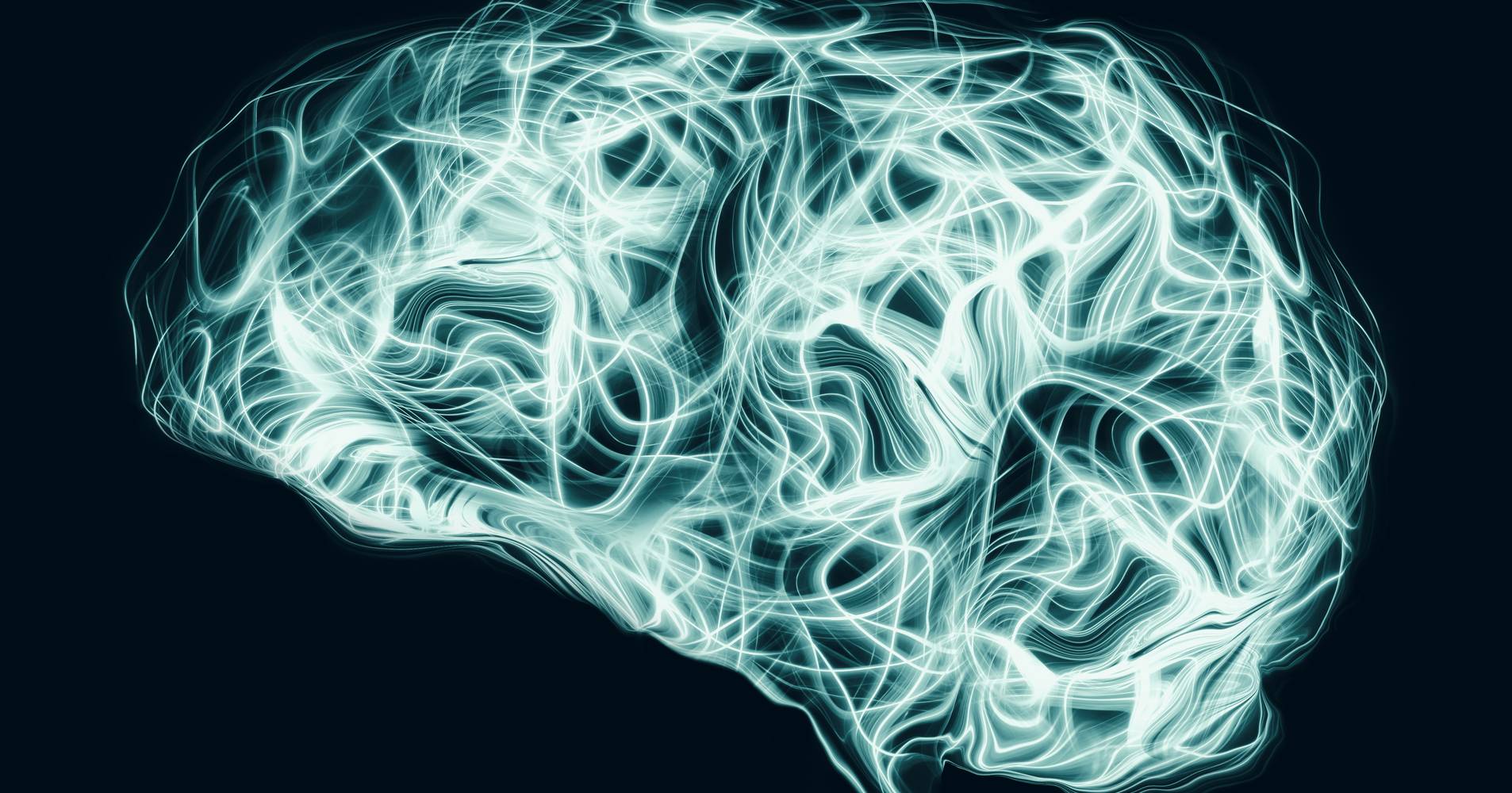 Herramienta de inteligencia artificial detecta la enfermedad de Alzheimer incluso sin síntomas