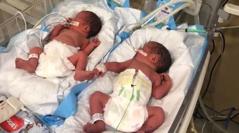 Casal com “barriga de aluguer” na Ucrânia enfrenta desafio de trazer para casa gémeos prematuros