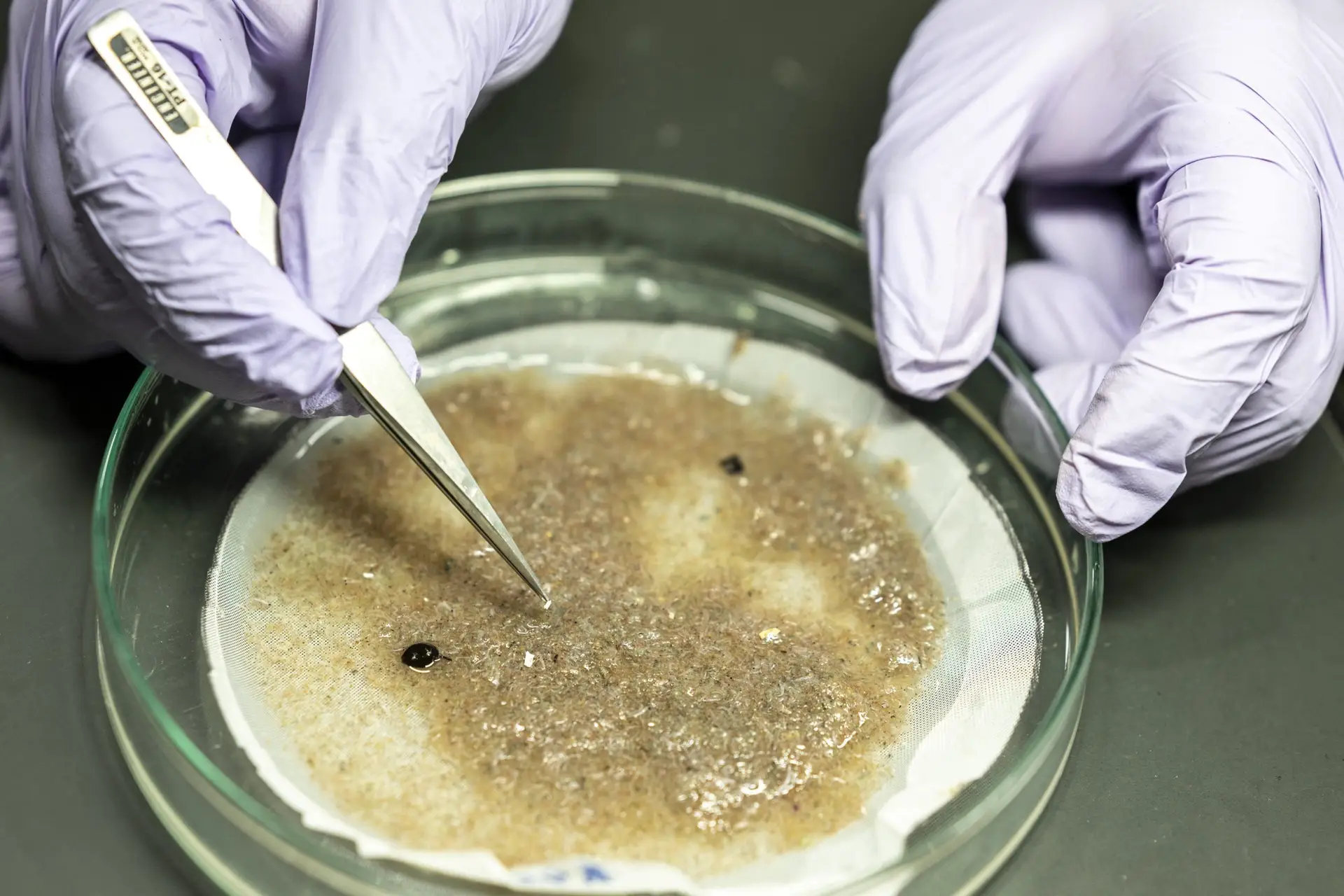 Microplásticos encontrados pela primeira vez na corrente sanguínea de seres humanos