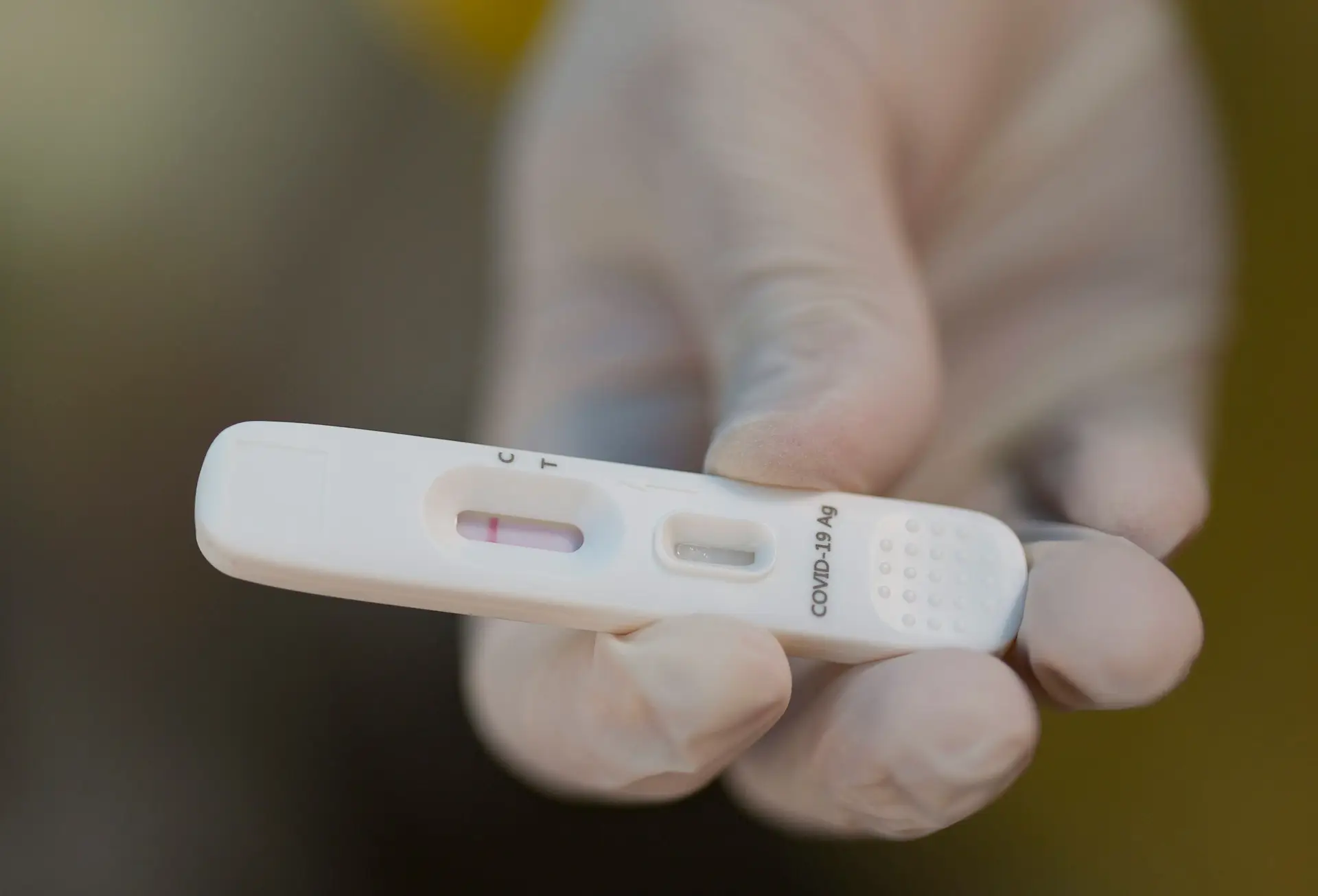 Portugal com 59.434 casos de covid-19 e 145 mortes na semana de 05 a 11 de abril
