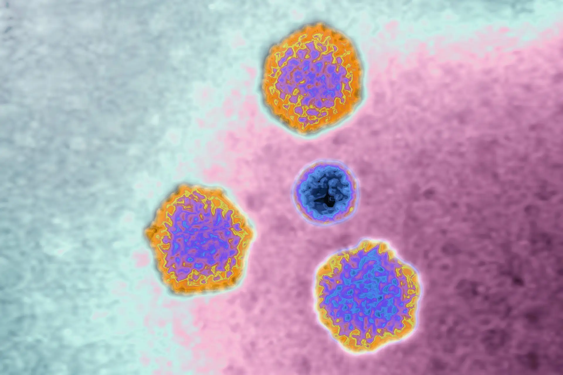 Novos casos de hepatite de origem desconhecida detetados em crianças na Dinamarca, Irlanda, Holanda e EUA