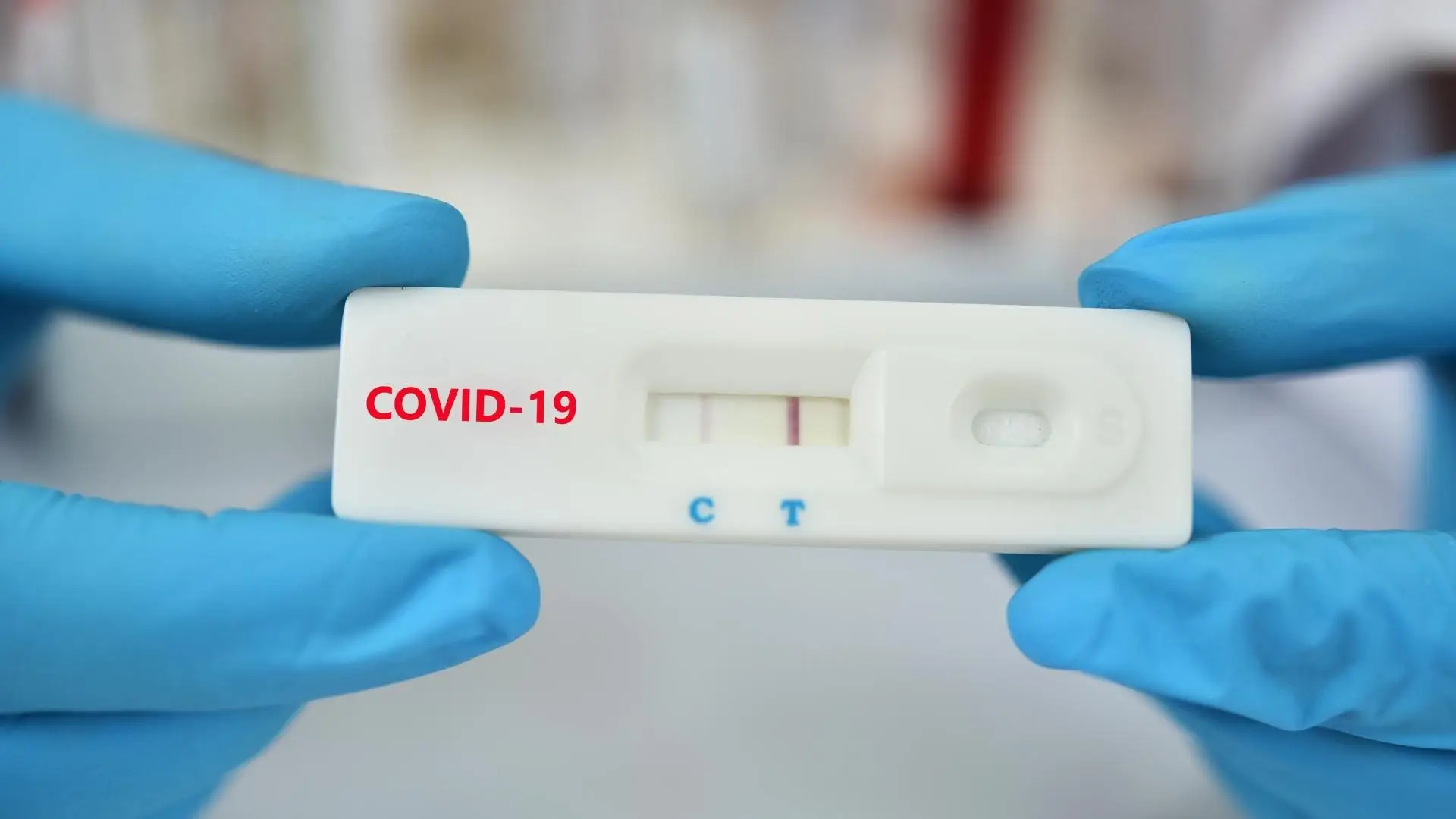 Covid-19: Governo admite repor gratuitidade dos testes se situação se agravar