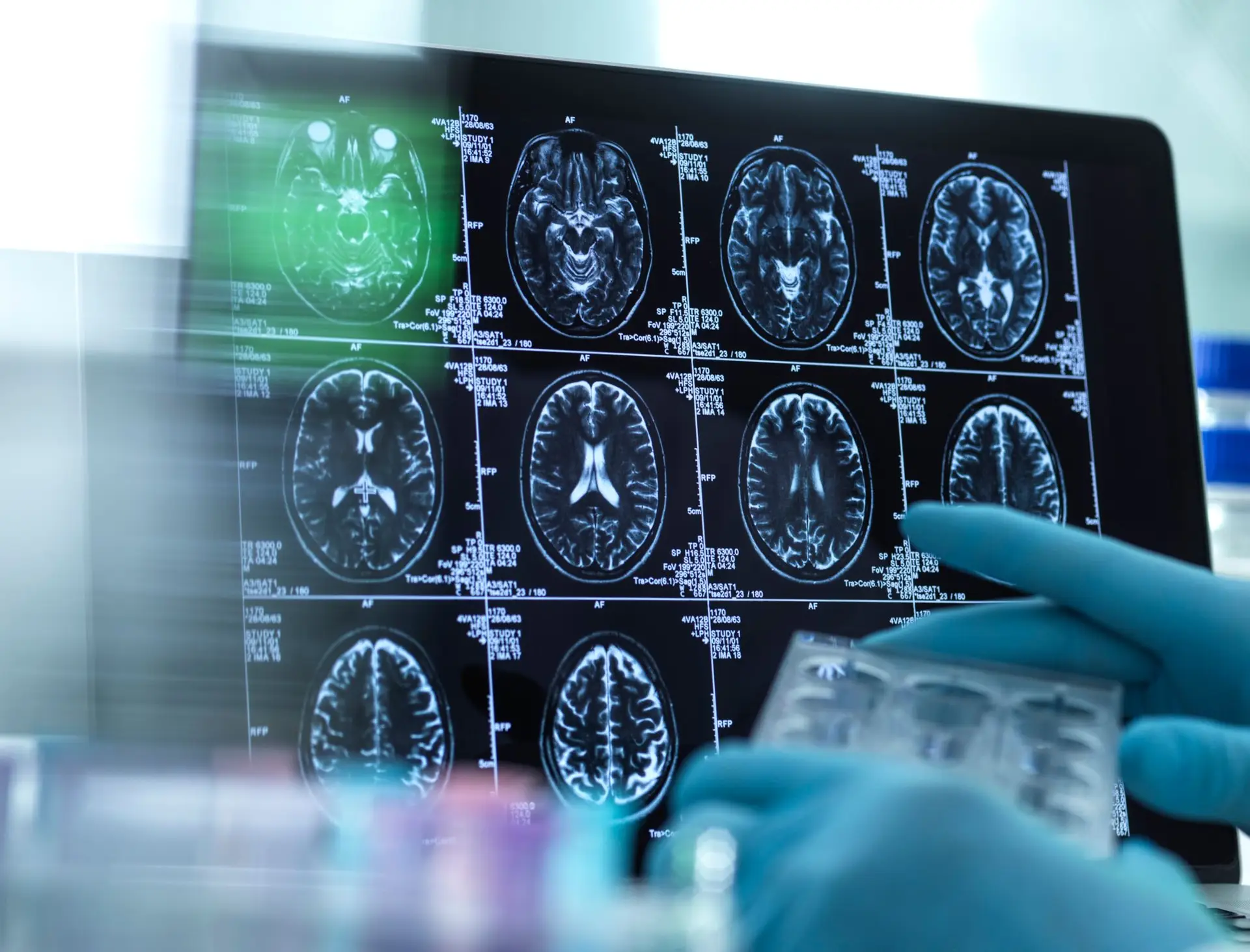 Investigadores identificam “local exato” nos neurónios que causa dor neuropática