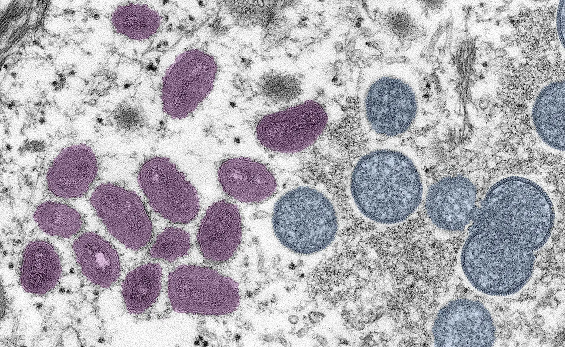 Monkeypox: DGS divulga cuidados a ter durante e após contactos sexuais