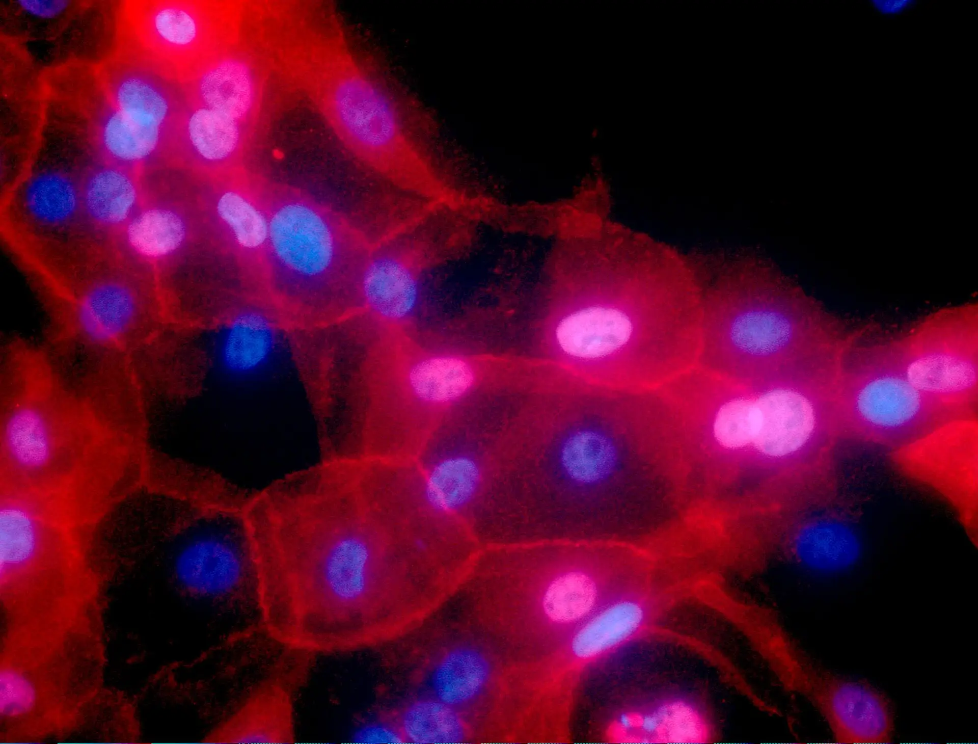 Propagação do cancro da mama é mais rápida durante o sono