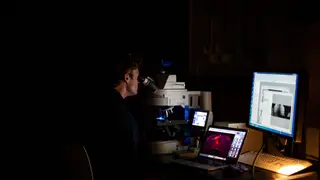 Descoberta nova ferramenta que melhora tratamentos do cancro do pâncreas
