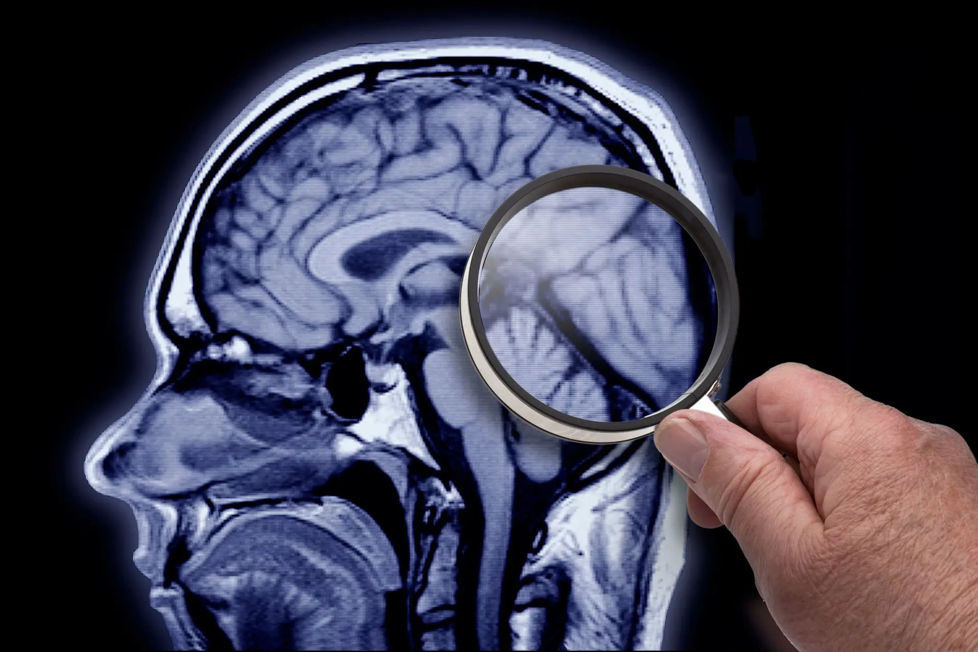 Drug Shadam authorized to delay cognitive deficit in patients with Alzheimer's in the European Union
