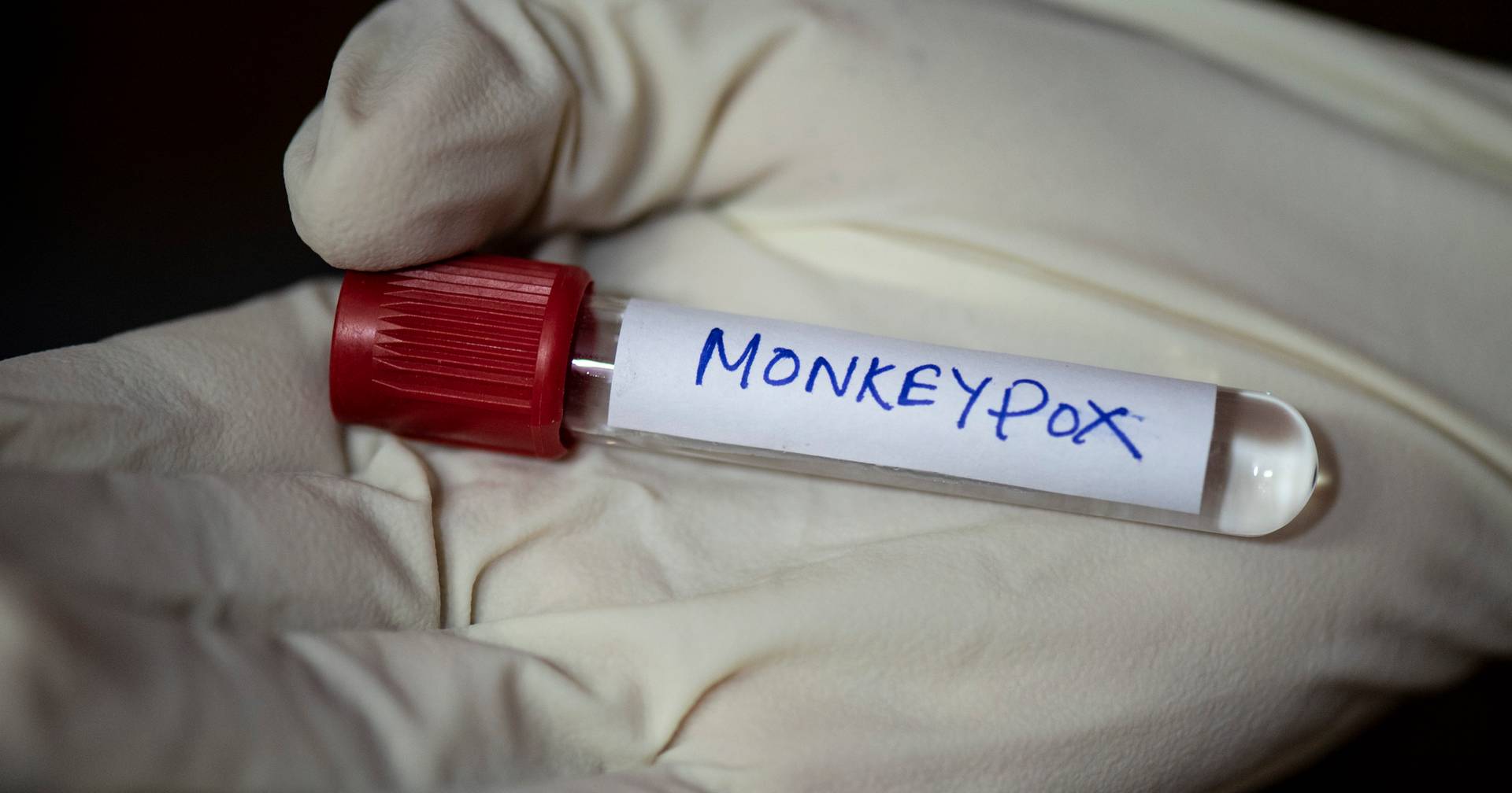 Los casos de viruela del mono en Portugal ascienden a 944