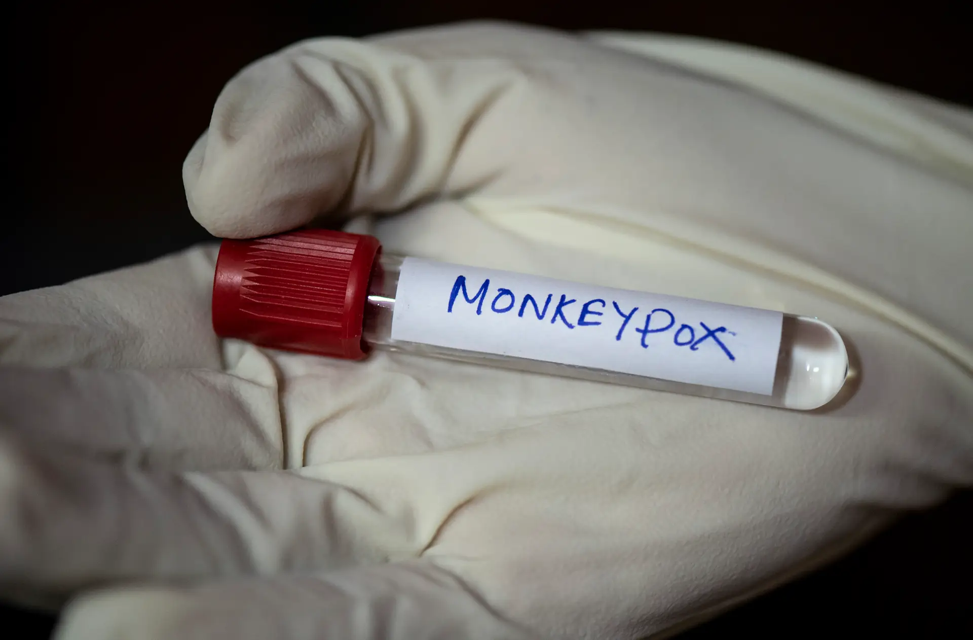 Casos de varíola dos macacos aumentaram 20% na última semana