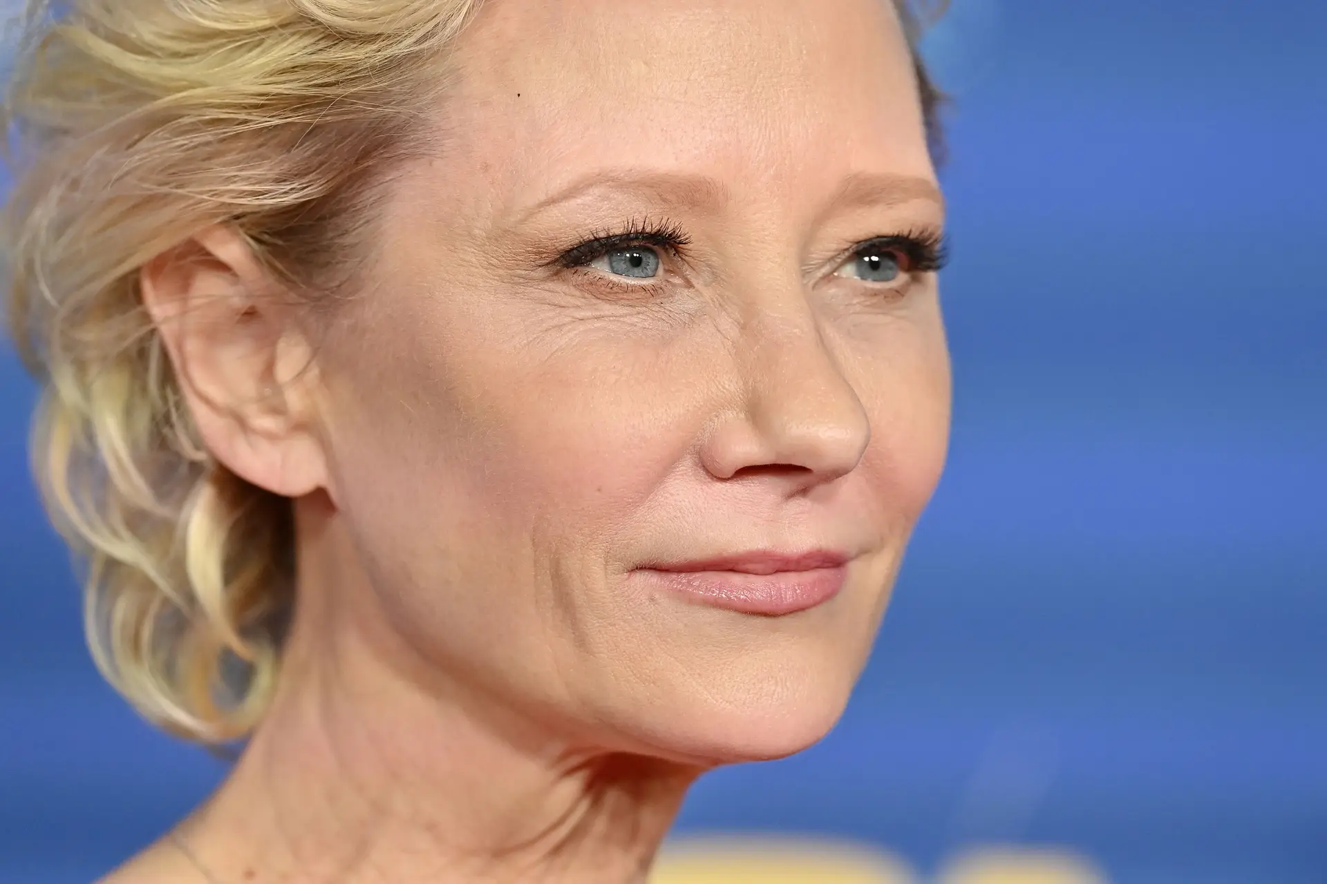 Atriz Anne Heche em estado crítico após sofrer acidente de carro em Los Angeles