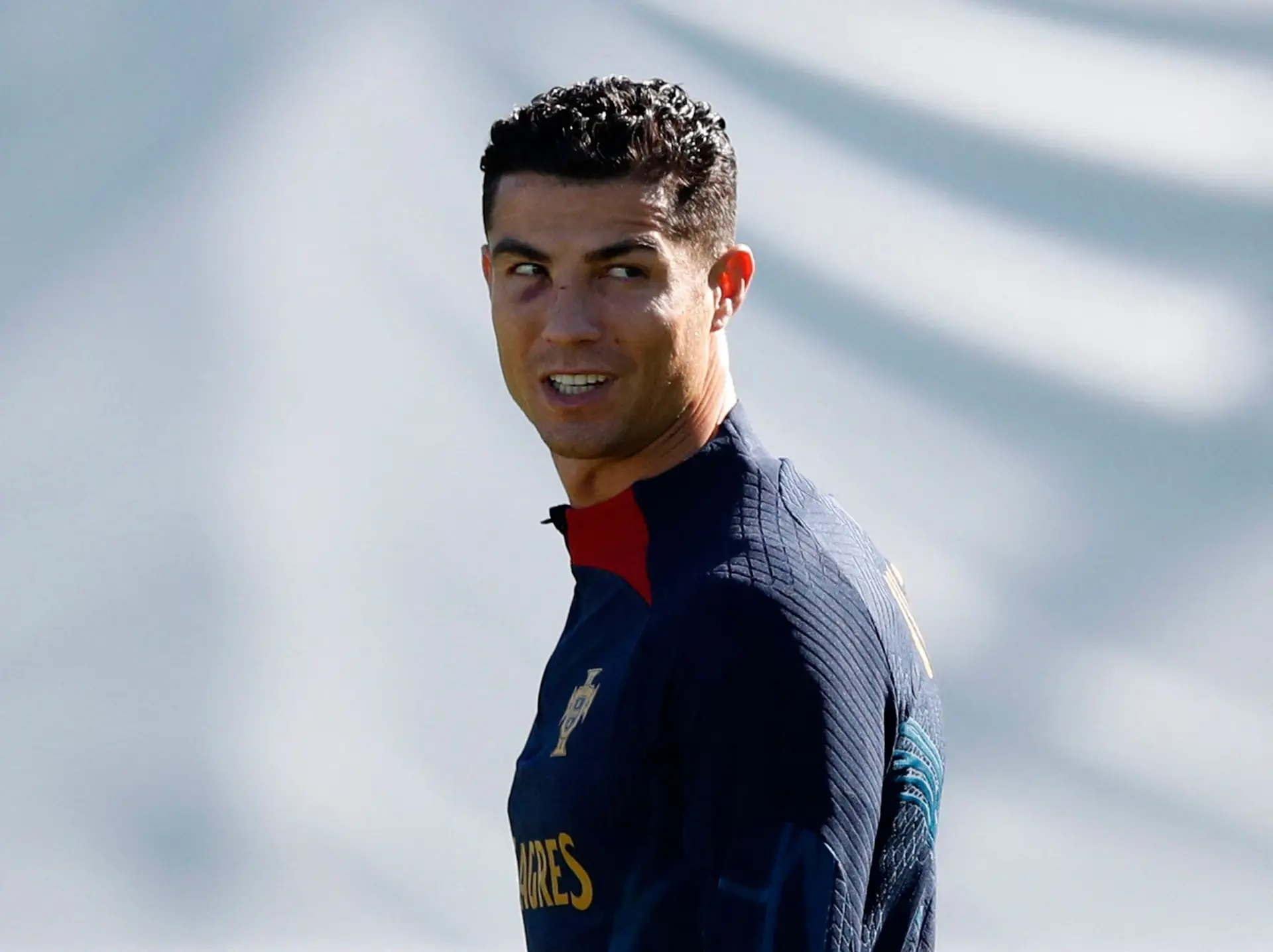 As marcas no rosto de Ronaldo em destaque no treino da Seleção