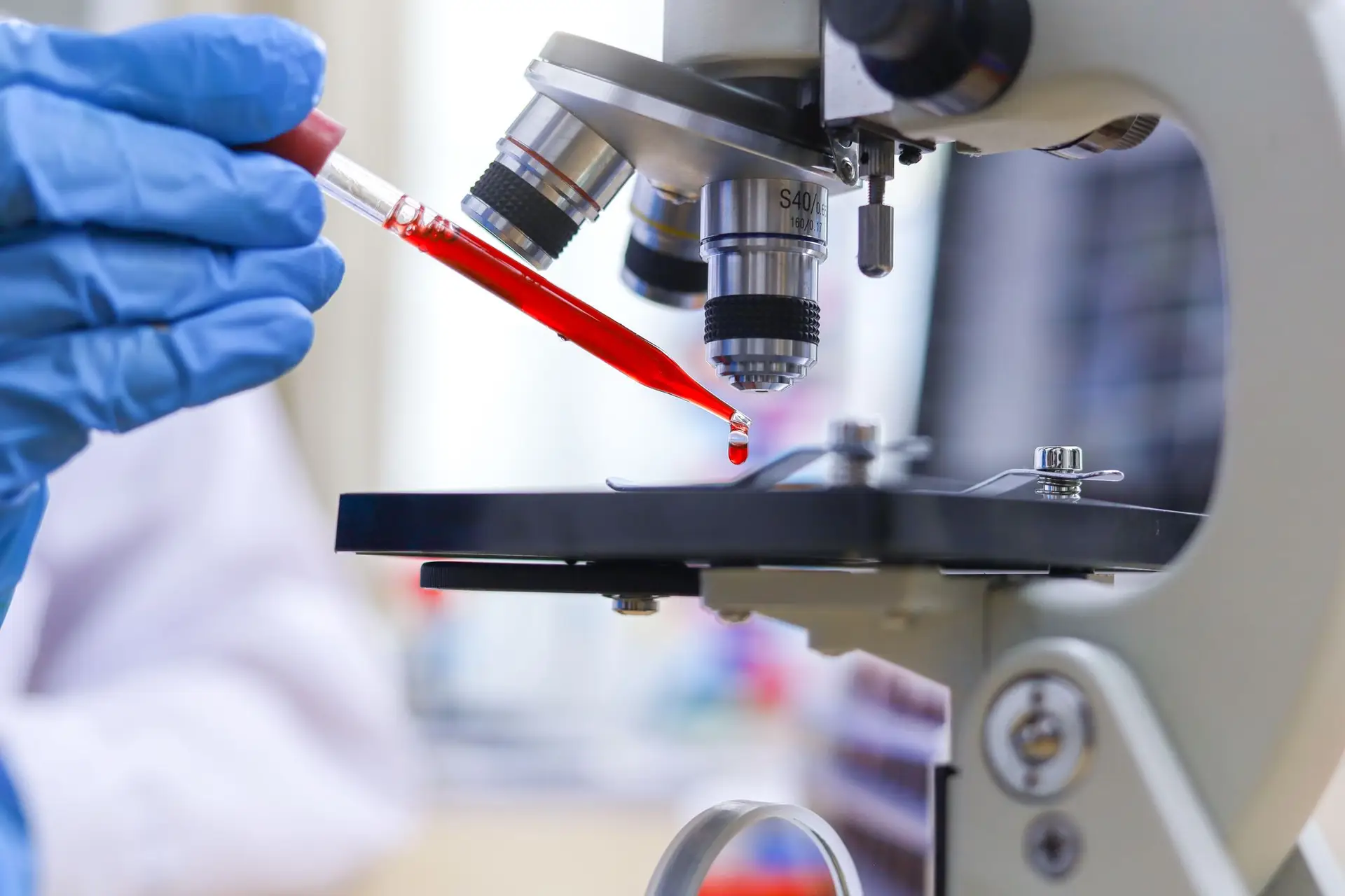 Accetta il trattamento di prevenzione degli Stati Uniti per affrontare l'HIV